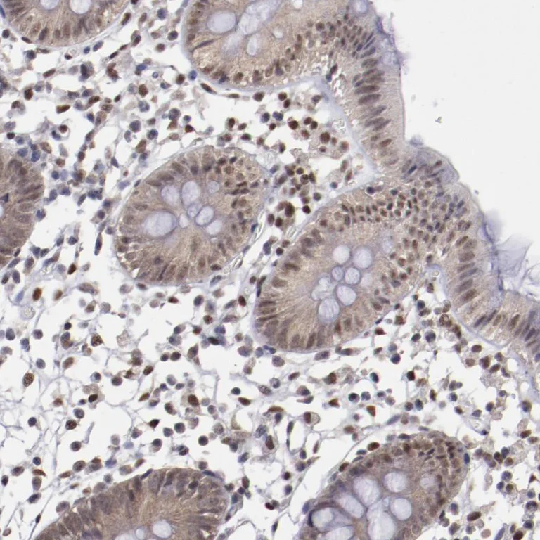 Immunohistochemistry (Formalin/PFA-fixed paraffin-embedded sections) - Anti-ARNT Antibody (AB327170)