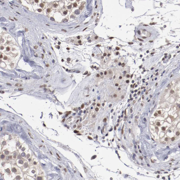 Immunohistochemistry (Formalin/PFA-fixed paraffin-embedded sections) - Anti-ARNT Antibody (AB327170)