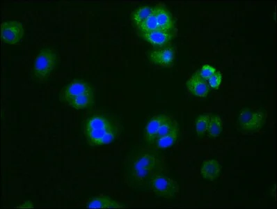Immunocytochemistry/ Immunofluorescence - Anti-Aromatase antibody [1H1] (AB314002)