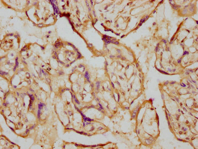 Immunohistochemistry (Formalin/PFA-fixed paraffin-embedded sections) - Anti-Aromatase antibody [1H1] (AB314002), expandable thumbnail