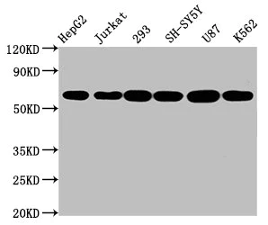Western blot - Anti-Aromatase antibody [1H1] (AB314002)