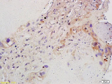 Immunohistochemistry (Formalin/PFA-fixed paraffin-embedded sections) - Anti-Aromatase antibody (AB215443)