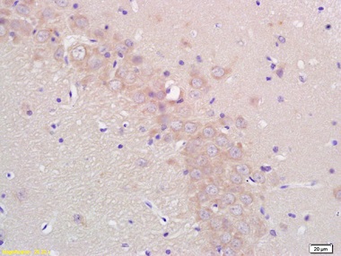 Immunohistochemistry (Formalin/PFA-fixed paraffin-embedded sections) - Anti-Aromatase antibody (AB215443), expandable thumbnail