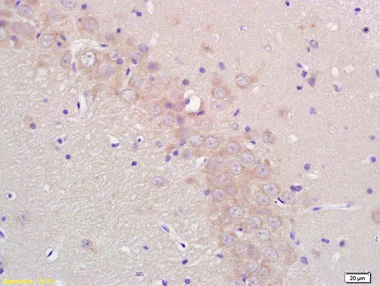 Immunohistochemistry (Formalin/PFA-fixed paraffin-embedded sections) - Anti-Aromatase antibody (AB215443)