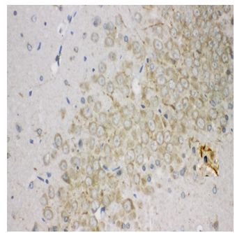 Immunohistochemistry (Formalin/PFA-fixed paraffin-embedded sections) - Anti-Aromatase antibody - C-terminal (AB191093)