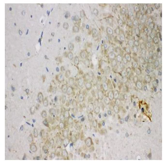Immunohistochemistry (Formalin/PFA-fixed paraffin-embedded sections) - Anti-Aromatase antibody - C-terminal (AB191093)