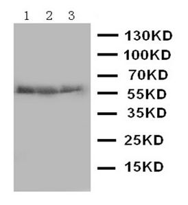 Western blot - Anti-Aromatase antibody - C-terminal (AB191093)