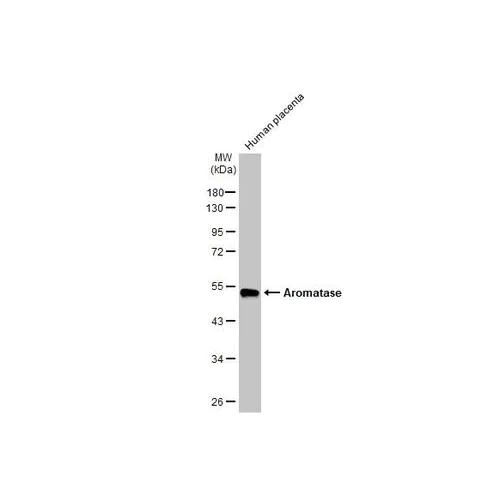 Western blot - Anti-Aromatase antibody [HL2339] (AB317200)