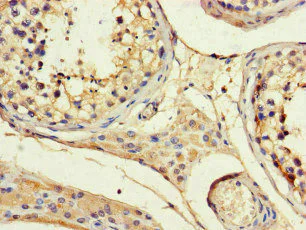 Immunohistochemistry (Formalin/PFA-fixed paraffin-embedded sections) - Anti-ARP1 antibody (AB222812)