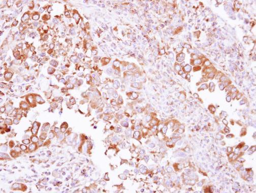 Immunohistochemistry (Formalin/PFA-fixed paraffin-embedded sections) - Anti-ARP1 antibody (AB227425), expandable thumbnail