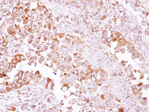Immunohistochemistry (Formalin/PFA-fixed paraffin-embedded sections) - Anti-ARP1 antibody (AB227425)