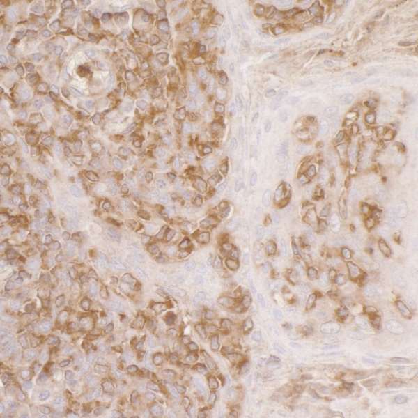 Immunohistochemistry (Formalin/PFA-fixed paraffin-embedded sections) - Anti-Arp2 antibody (AB226476)