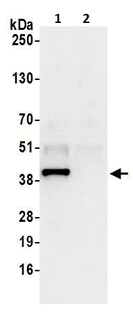 Immunoprecipitation - Anti-Arp2 antibody (AB226476)