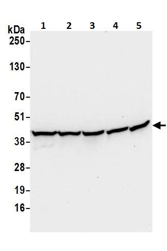 Western blot - Anti-Arp2 antibody (AB226476)