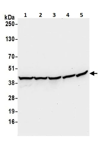 Western blot - Anti-Arp2 antibody (AB226476)