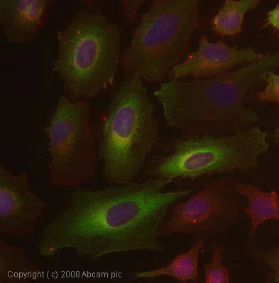 Immunocytochemistry/ Immunofluorescence - Anti-Arp2 antibody (AB47654)