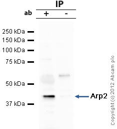 Immunoprecipitation - Anti-Arp2 antibody (AB47654), expandable thumbnail