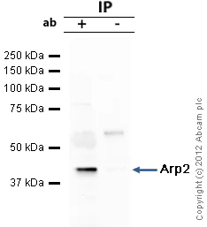Immunoprecipitation - Anti-Arp2 antibody (AB47654)