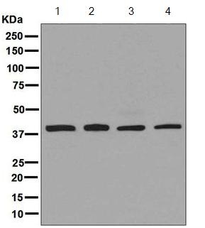 Western blot - Anti-Arp2 antibody [EPR7979] (AB129018), expandable thumbnail