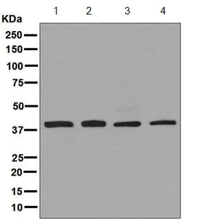 Western blot - Anti-Arp2 antibody [EPR7979] (AB129018)