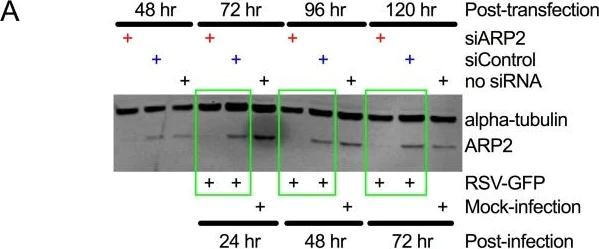 Western blot - Anti-Arp2 antibody [EPR7979] (AB129018)