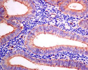 Immunohistochemistry (Formalin/PFA-fixed paraffin-embedded sections) - Anti-Arp2 antibody [EPR7980] (AB128934), expandable thumbnail