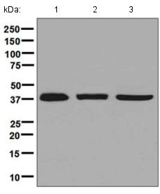 Western blot - Anti-Arp2 antibody [EPR7980] (AB128934), expandable thumbnail