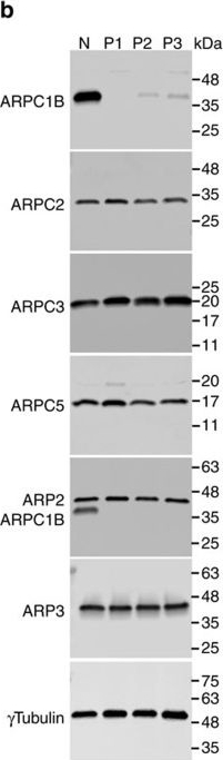 Western blot - Anti-Arp2 antibody [EPR7980] (AB128934), expandable thumbnail