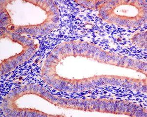Immunohistochemistry (Formalin/PFA-fixed paraffin-embedded sections) - Anti-Arp2 antibody [EPR7980] - BSA and Azide free (AB240037)