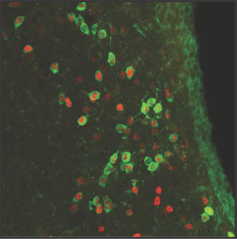 Immunocytochemistry/ Immunofluorescence - Anti-Arp2 antibody [FMS96] (AB49674)
