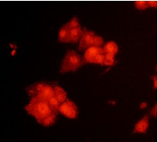 Immunocytochemistry - Anti-Arp2 (phospho T237 + T238) antibody (AB119766)