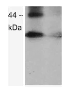 Western blot - Anti-Arp2 (phospho T237 + T238) antibody (AB119766)