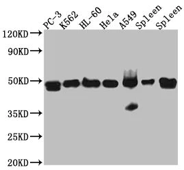 Western blot - Anti-Arp3 antibody [7E5] (AB288378)