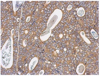Immunohistochemistry (Formalin/PFA-fixed paraffin-embedded sections) - Anti-Arp3 antibody (AB151289)