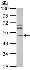 Western blot - Anti-Arp3 antibody (AB151289), expandable thumbnail