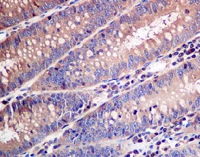 Immunohistochemistry (Formalin/PFA-fixed paraffin-embedded sections) - Anti-Arp3 antibody [EPR10428(B)] (AB151729)