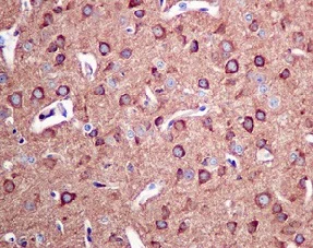 Immunohistochemistry (Formalin/PFA-fixed paraffin-embedded sections) - Anti-Arp3 antibody [EPR10428(B)] (AB151729)
