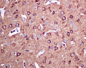 Immunohistochemistry (Formalin/PFA-fixed paraffin-embedded sections) - Anti-Arp3 antibody [EPR10428(B)] - BSA and Azide free (AB249046), expandable thumbnail