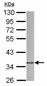 Western blot - Anti-ARPC1B antibody (AB126941)