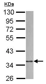 Western blot - Anti-ARPC1B antibody (AB126941)