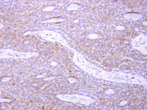 Immunohistochemistry (Formalin/PFA-fixed paraffin-embedded sections) - Anti-ARPC1B antibody (AB227082), expandable thumbnail