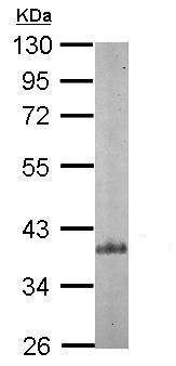 Western blot - Anti-ARPC1B antibody (AB227082), expandable thumbnail