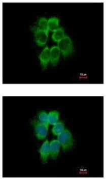 Immunocytochemistry/ Immunofluorescence - Anti-ARPC1B antibody (AB227427)