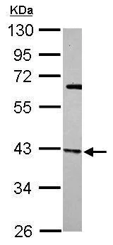 Western blot - Anti-ARPC1B antibody (AB227427)