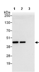 Immunoprecipitation - Anti-ARPC1B antibody (AB99314)