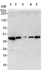Western blot - Anti-ARPC1B antibody (AB99314)