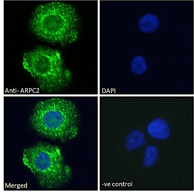 Immunocytochemistry/ Immunofluorescence - Anti-ARPC2 antibody (AB11798)