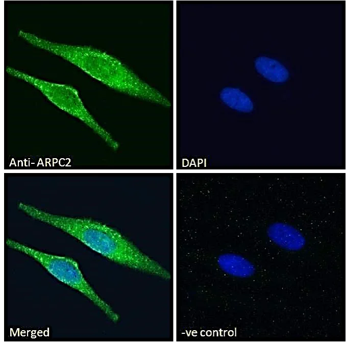 Immunocytochemistry/ Immunofluorescence - Anti-ARPC2 antibody (AB11798)