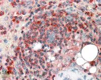 Immunohistochemistry (Formalin/PFA-fixed paraffin-embedded sections) - Anti-ARPC2 antibody (AB11798)