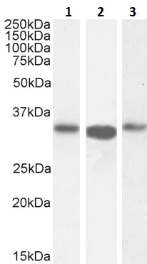 Western blot - Anti-ARPC2 antibody (AB11798)